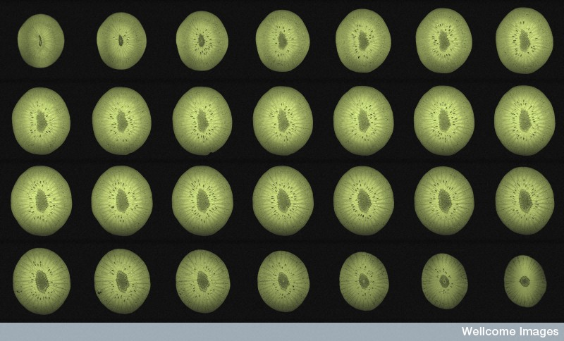 Illustration for article titled This Is How Your Fruits and Vegetables Look in an MRI Machine